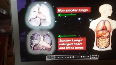 Photo 2 de Hypnose : Arrêter de fumer