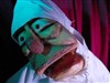 Malade ! - Théâtre des Chartreux