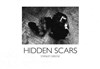 Hidden Scars - Galerie Polka - Cour de Venise