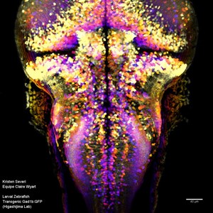 Affiche de Illuminer les neurones sous-tendant le mouvement